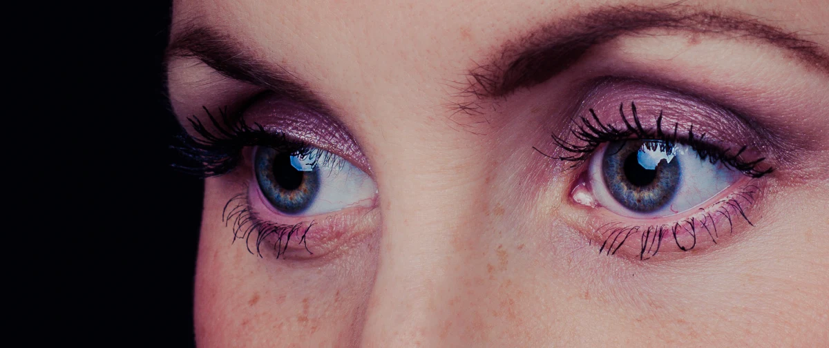 Eyes: whiter sclera, fewer red vessels, brighter iris — after