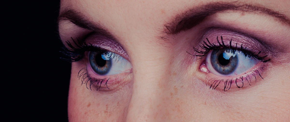 Eyes: whiter sclera, fewer red vessels, brighter iris — before